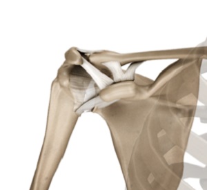 Acromioclavicular (AC) Joint Reconstruction 1