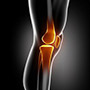 Knee Trauma Reconstruction