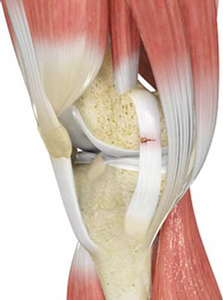 Shoulder Ligament Injuries